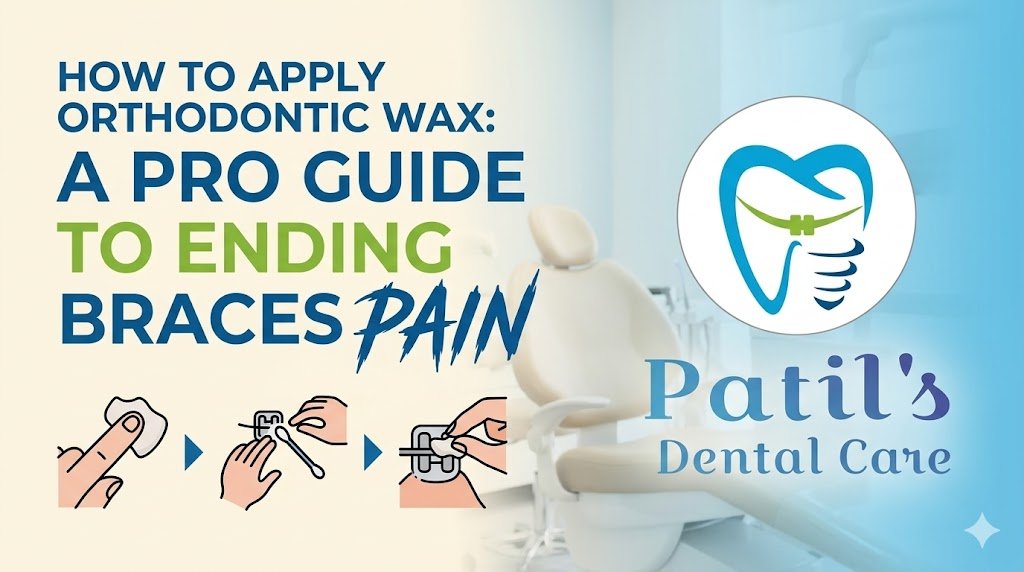 How to Apply Orthodontic Wax: A Pro Guide to Ending Braces Pain
