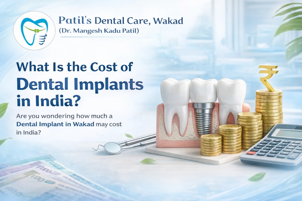 What Is the Cost of Dental Implants in India