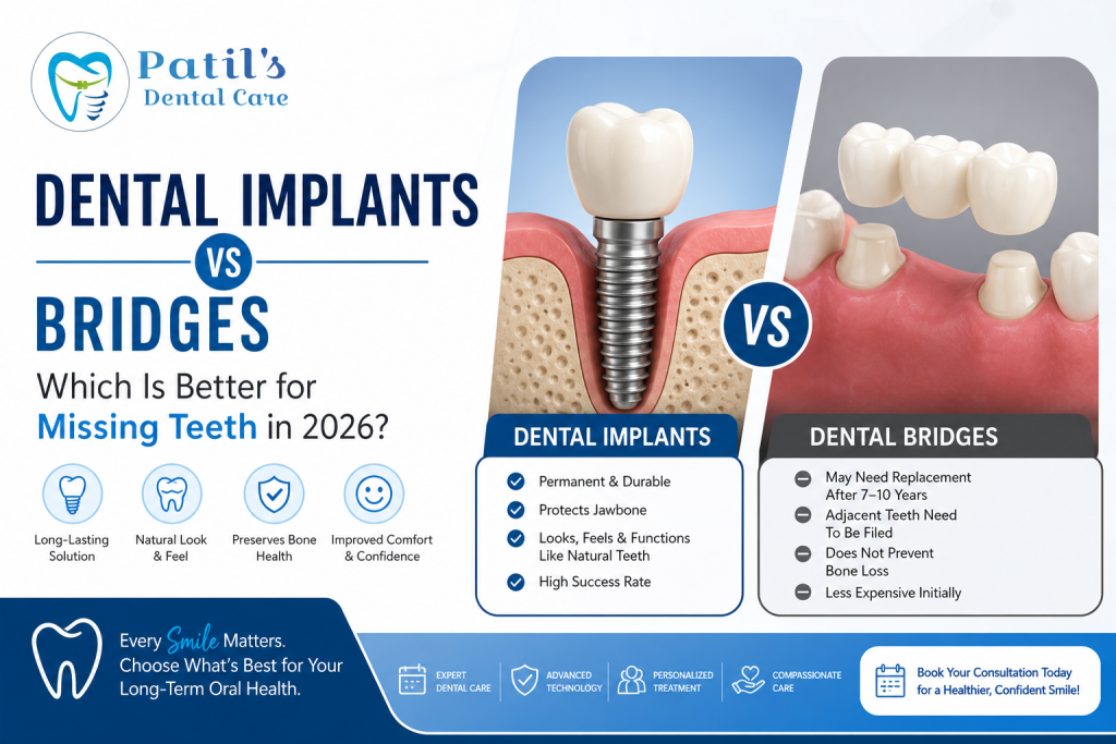 dental implants vs bridges Wakad 2026