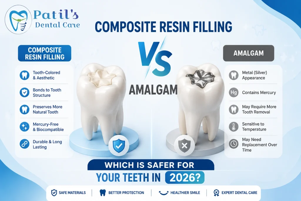 composite resin filling vs amalgam Wakad