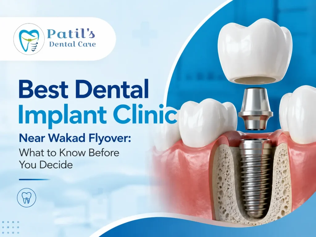 Dental Implant Clinic Near Wakad Flyover